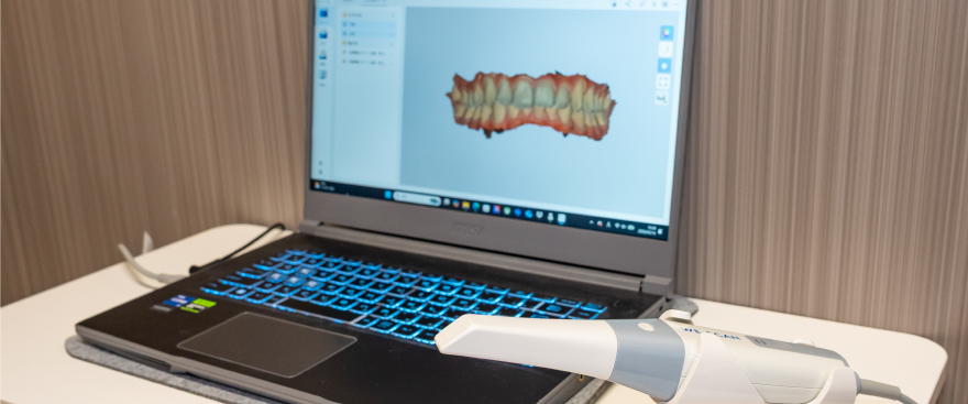 口腔内スキャナーを使用した治療