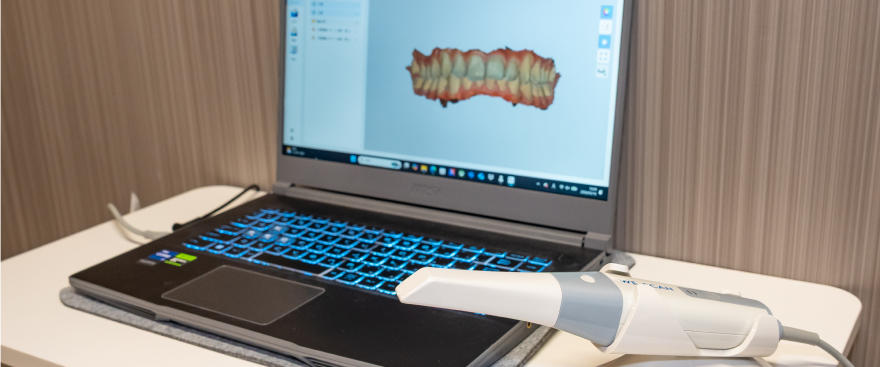 口腔内スキャナーを使用した治療